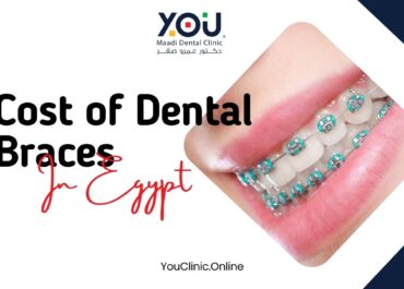 The Cost of Dental Braces in Egypt