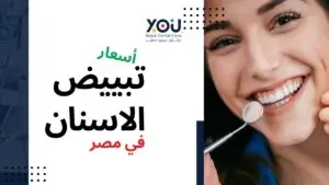 اسعار تبييض الأسنان في مصر