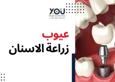 عيوب زراعة الأسنان: حقائق هامة عليك معرفتها قبل اتخاذ القرار