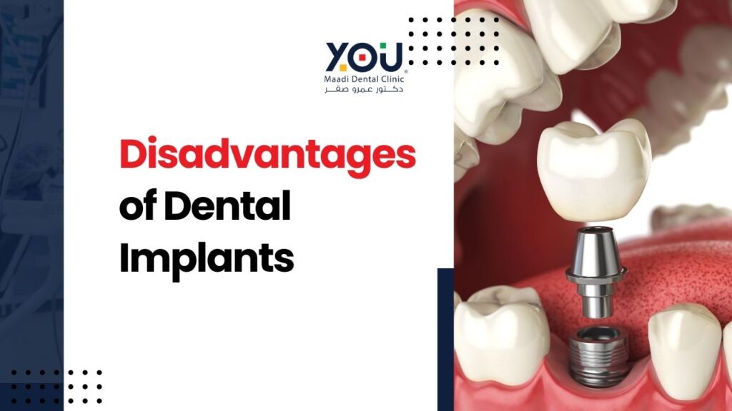 Disadvantages of dental implants