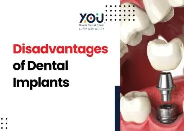 The Disadvantages of Dental Implants