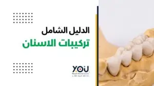 تركيبات الأسنان