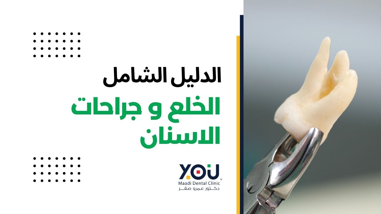 خدمات جراحات الاسنان في عيادات يو المعادي لطب الاسنان
