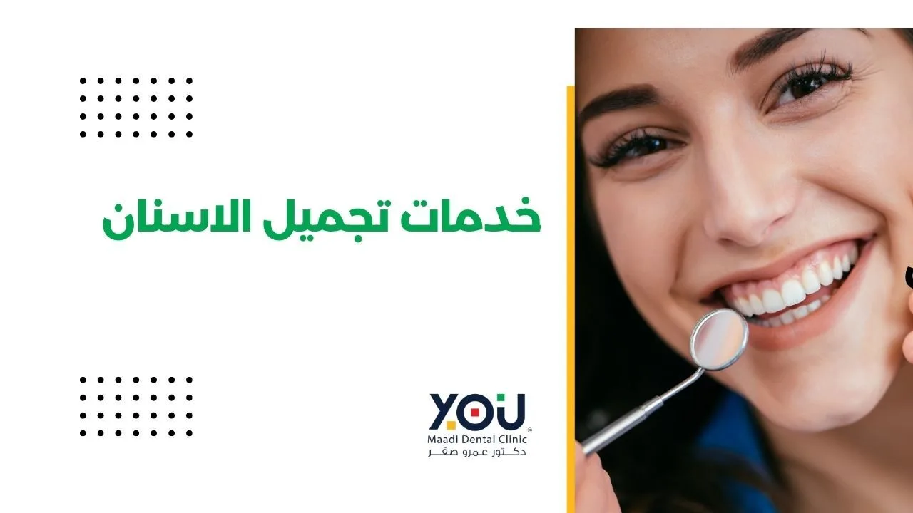 خدمات تجميل الأسنان