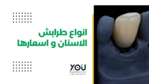 أنواع طرابيش الأسنان واسعارها