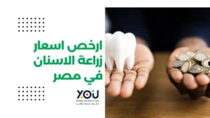 ارخص اسعار زراعة الاسنان في مصر
