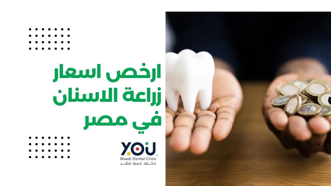 ارخص اسعار زراعة الاسنان في مصر
